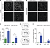 Activation of ERK and PKA signaling in the DA-denervated striatum upon chem