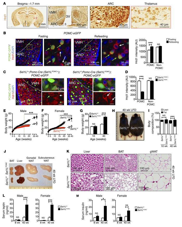 POMC neuron–specific Sel1LPOMC mice develop age-associated obesity and h...