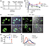 Effects of Jedi T cell injections in the setting of NTSN.