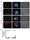 Effects of BC rupture on glomerular localization of CD68 macrophages.