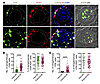 Effects of BC rupture on the distribution of proliferating CD8+ T cells.