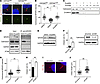 Eupatilin restores centrosomal NPHP5 levels in CEP290null RPE1 cells by inh