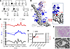 The NRCTC family heterozygous for C3 Asn1115 mutation.