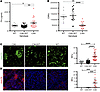 Complement dysregulation in C3KI mice.