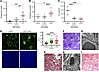 C3KI phenotype is rescued through genetic deletion of complement C5.