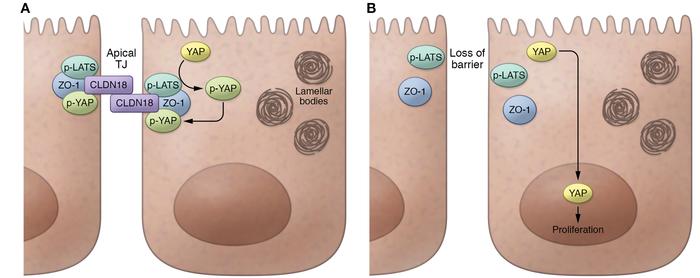 Schematic summarizing the effects of CLDN18 deficiency in type 2 alveola...