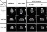 Multimodality Image Registration Using Spatial Procrustes Analysis ...