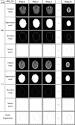 Multimodality Image Registration Using Spatial Procrustes Analysis ...