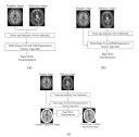 Symmetry | Free Full-Text | Multi-Modal Rigid Image Registration ...