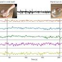 PDF) Self-Calibrating Protocols Enhance Wearable EEG Diagnostics ...