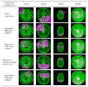 J. Imaging | Free Full-Text | Multi-Modal Medical Image ...