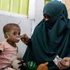 A child diagnosed with severe acute malnutrition is fed ready-to-use therapeutic food by her mother at a refugee nutrition facility in Cox's Bazar, Bangladesh.