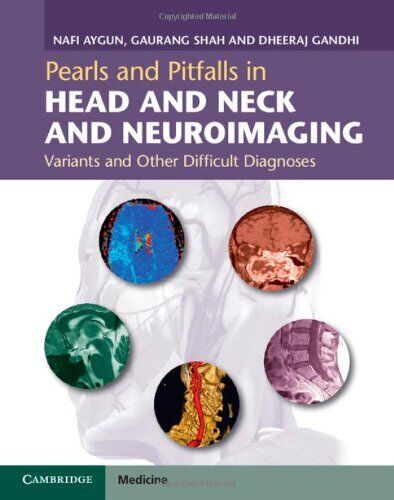 PEARLS AND PITFALLS IN HEAD AND NECK AND NEUROIMAGING: By Nafi Aygun & Gaurang - Afbeelding 1 van 1