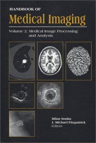 "Manual de imágenes médicas, volumen 2. Procesamiento y análisis de imágenes médicas (S) - Imagen 1 de 1