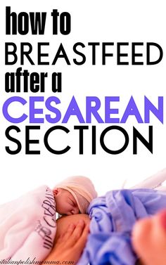 A new mom breastfeeding her newborn baby right after a cesarean section delivery. C Section Recovery Timeline, Breastfeeding After C Section, Postpartum Symptoms, C Section Workout, How To Breastfeed, C Section Scars, C Section Recovery, Cesarean Section, Hospital Bag Checklist