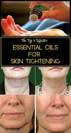 Get Rid Of Saggy Skin, Skin Tightening Essential Oil, Diy Skin Tightening, For Skin Tightening, Top Essential Oils, Essential Oils For Skin, Skin Care Wrinkles, Saggy Skin, Oil Uses