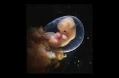 day 37-40 Human Embryo, Microscopic Photography, Fetal Development, Pregnancy Nutrition, Unborn Baby, Pregnancy Birth, Make You Cry