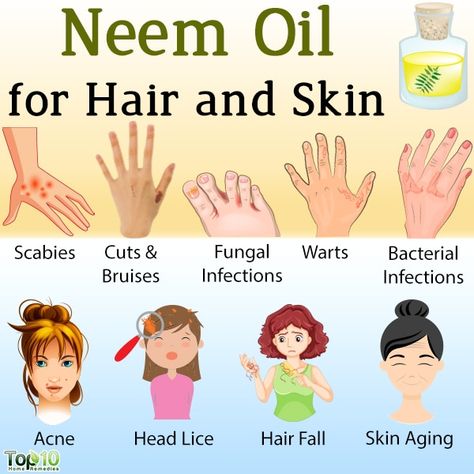 Neem Oil for Hair and Skin: 9 Benefits and How to Use It | Top 10 Home Remedies Benefits Of Neem Oil For Skin, Neem Oil Benefits Hair, How To Make Neem Oil At Home, Neem Oil Benefits Skin, Neem Oil Recipes, Neem Oil Benefits, Neem Oil For Skin, Benefits Of Neem Oil, Neem Oil For Hair