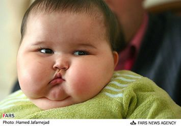 If a baby is born obese they are 2-9 times more likely to become obese adults than a normal baby. An obese baby can be an affect of the mother’s pregnancy. Fat Babies, Baby Cheeks, Face Fat, Baby Fat, Chubby Babies, Childhood Obesity, Chubby Cheeks, Diet Pills, Healthy Ideas