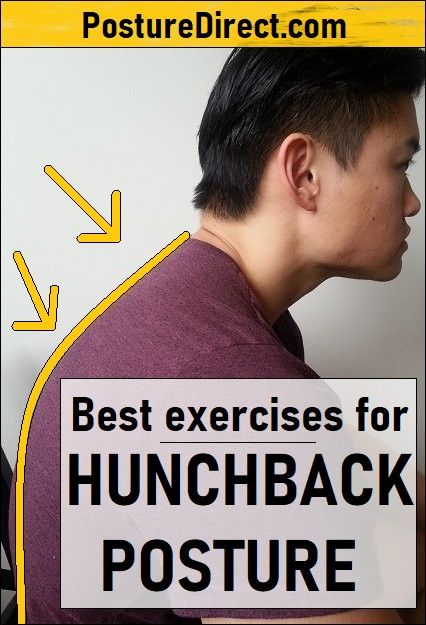 Hunchback Posture Exercises Exercise For Hunch Back Bad Posture, Correcting Posture Exercises, Exercise For Hunchback, Fix Hunchback Bad Posture, How To Get Rid Of A Hunchback Neck, Fix Hunchback, Weighted Ball Exercises, Hunchback Posture, Bad Posture Exercises