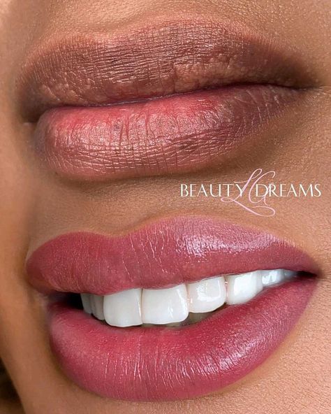 Lip Blushing on Dark Lips: Can Lip Blush Neutralize Dark Lips? Lipblush Before And After, Lip Blushing Before And After, Lipstick For Dark Lips, Lip Blushing Tattoo Colors, Lip Blushing Tattoo Before And After, Lip Blushing Tattoo, Lip Hyperpigmentation, Cosmetic Lip Tattoo, Lip Color Tattoo