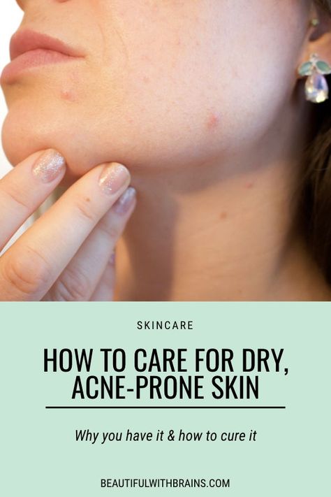 Skin Care For Acne And Dry Skin, Dry Skin Acne Skincare, Dry Sensitive Acne Prone Skin Skincare, Skincare Routine For Dry Sensitive Acne Prone Skin, Acne Prone Dry Skin Skincare, Sensitive Acne Prone Skin Care Routine, Best Makeup For Acne Prone Skin, Skincare For Dry Acne Prone Skin, Dry Acne Prone Skin Routine