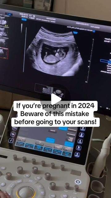 Snapframe | Live Ultrasound Frame on Instagram: "LlNK lN BlO to get your ultrasound frame🥰👉🔗" 10 Week Ultrasound Pictures, 8 Weeks Pregnant Ultrasound, 9 Weeks Pregnant Ultrasound, Ultrasound Picture Ideas, Baby Gender Ultrasound, 4d Ultrasound Pictures, 10 Week Ultrasound, Ultrasound Humor, 12 Week Ultrasound