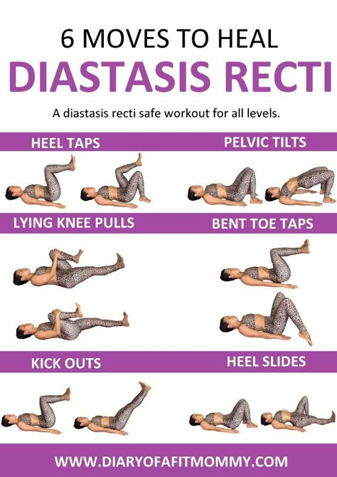 Heal and repair your Diastasis Gap at home with this workout. These exercises are gentle for the postpartum core. Recti Diastasis, Heal Diastasis Recti, After Baby Workout, Healing Diastasis Recti, Post Baby Workout, Postpartum Workouts, Fitness Diary, Postpartum Workout, Diastasis Recti Exercises