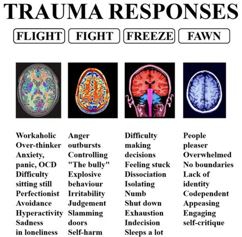 Flight, Fight, Freeze or Fawn Nervus Vagus, Psychology Notes, Psychology Studies, Brain Facts, Mental Health Facts, The Human Brain, Mental Health Therapy, Brain Science, Dissociation