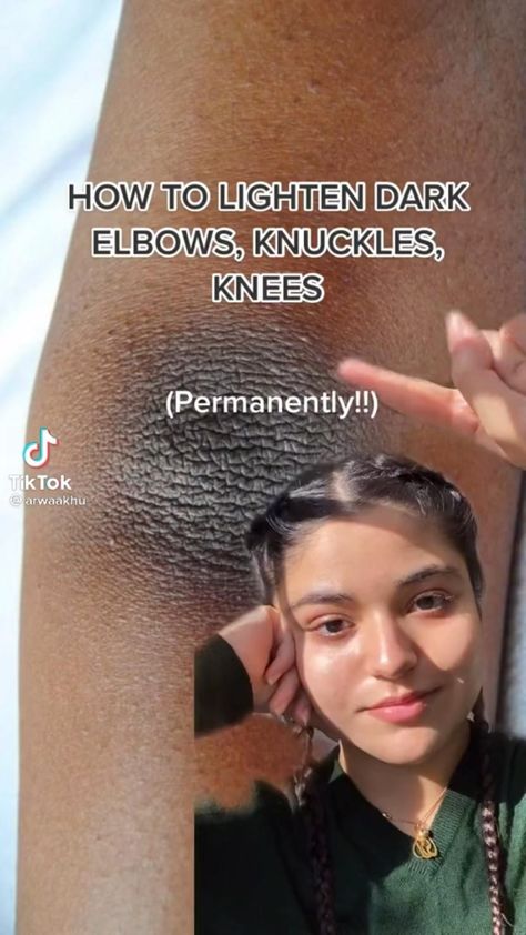 Dark Knees, Beginner Skin Care Routine, Skin Care Basics, Face Skin Care Routine, Diy Skin Care Routine, Natural Face Skin Care, Serious Skin Care, Good Skin Tips, Basic Skin Care Routine