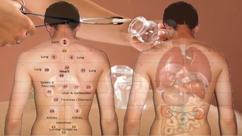 5 Benefits Of Cupping Therapy For Your Back | Top Natural Remedy What Is Cupping Therapy, Cupping Points, Wet Cupping, Benefits Of Cupping, Hijama Cupping, Fire Cupping, Relax Muscles, Cupping Massage, Massage Therapy Techniques