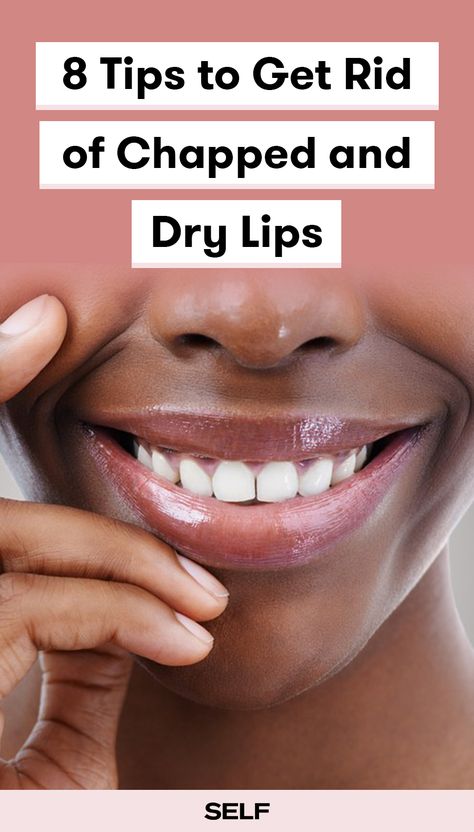 Looking for a severe chapped lips remedy as the weather gets colder? These simple products will help dry lips stay moisturized. Peeling Lips Remedies, Severely Chapped Lips Remedy, Dry Chapped Lips Remedy, Remedy For Dry Lips, Chap Lips Remedy, Heal Chapped Lips Fast, Hydrated Lips Tips, Natural Lip Moisturizer, How To Fix Chapped Lips