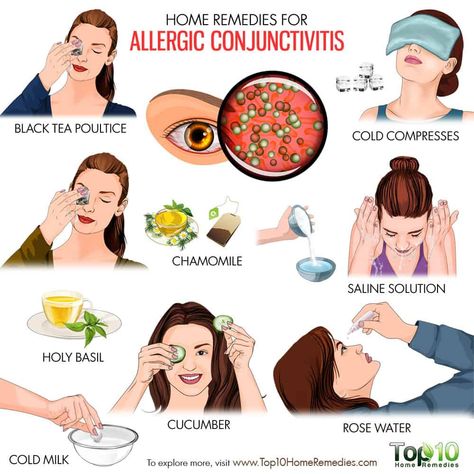 Home Remedies for Allergic Conjunctivitis | Top 10 Home Remedies Natural Allergy Medicine, Dry Eye Remedies, Cold Natural Remedies, Eye Health Tips, Pinkeye Remedies, Remedy For Cold, Allergy Eyes, Allergies Remedies, Remedies For Allergies