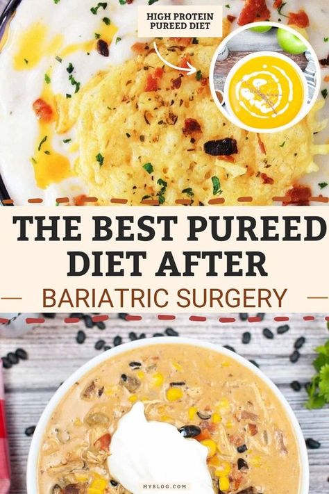 Fuel your post-surgery diet with these easy and tasty puree recipes! Perfect for the early phases of your weight loss journey, each recipe is nutritious and delicious.pureed foods after bariatric surgery, gastric bypass or gastric sleeve.Vsg Puree Recipes High Protein|Bariatric Recipes Sleeve Liquid Diet Bariatric Puree Recipes Sleeve, Bariactic Liquid Diet, Portion Size After Vsg, Post Op Bariatric Diet Stages, 1 Week Liquid Diet, 10 Day Pouch Reset For Sleeve, Life After Bariatric Sleeve, Liquid Phase After Wls, Gastric Bypass Pre Op Liquid Diet