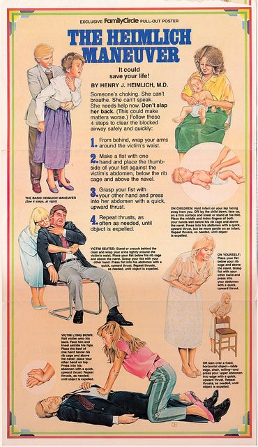 vintage heimlich maneuver poster http://www.pinterest.com/sthomas68/occupational-and-physical-therapy/ Heimlich Maneuver, First Aid Cpr, First Aid Tips, Emergency First Aid, Survival Life Hacks, Emergency Medicine, Survival Life, Emergency Prepping, Medical Knowledge