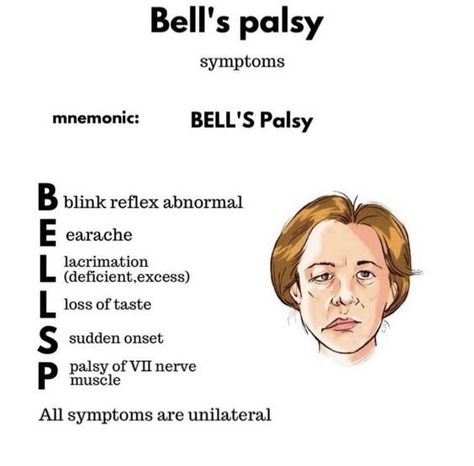 Bell's Palsy #nursingstudent #nursesrock #memorize - Image Credits: Laura Sotorres Pharmacy School Study, Medical Terminology Study, Bells Palsy, Medical Study, Nursing School Essential, Basic Anatomy, Nurse Study, Medical Notes, Nursing Student Tips