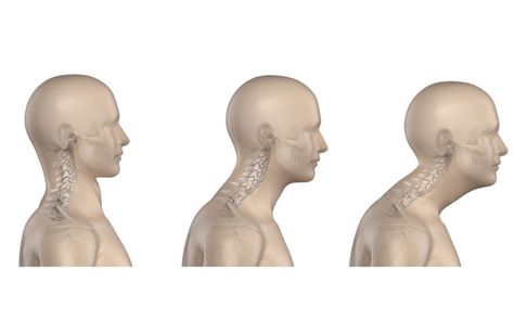 Neck Muscle Exercises, Desk Posture, Neck Posture, Neck Headache, Forward Head Posture Exercises, Chin Tuck, Text Neck, Forward Head Posture, Posture Exercises