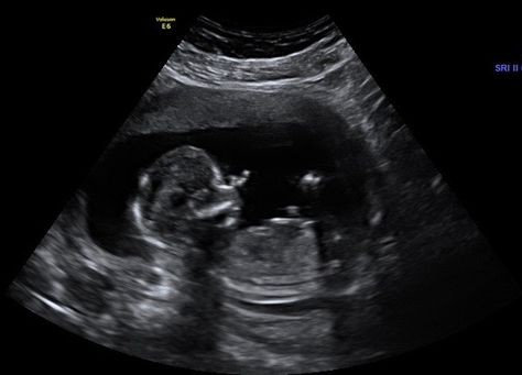 2D babyDATE Scan at Babybond Baby Scan Ultrasound, Sonography Aesthetic, Boy Ultrasound, Baby Scan Photos, 7 Month Baby, Hospital Waiting Room, 2 Month Baby, 4 Month Old Baby, 4 Month Baby