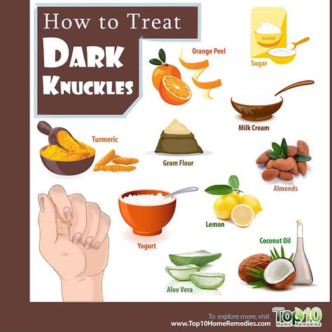 How to Treat Dark Knuckles | Top 10 Home Remedies Dark Knuckles Remedies, Best Skin Lightening Cream, Dark Knuckles, Oily Skin Face, Organic Skin Care Routine, Top 10 Home Remedies, Diy Coconut Oil, Skincare Diy, Coconut Oil For Face