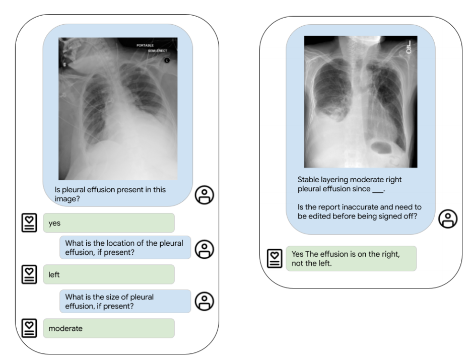 r/radiologyAI - ELIXR: Towards a general purpose X-ray artificial intelligence system through alignment of large language models and radiology vision encoders