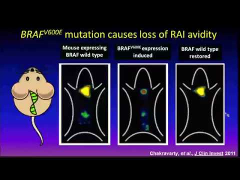 Treating Advanced Thyroid Carcinoma: Moving Beyond (and back to) Radioiodine