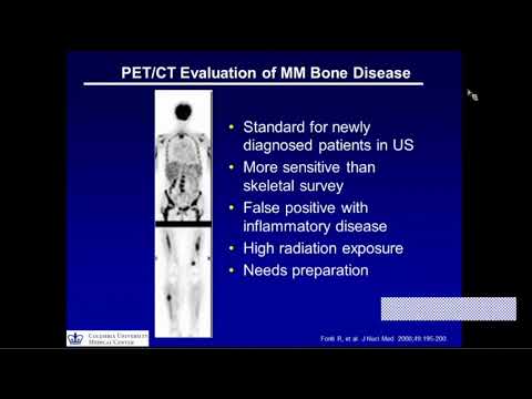 Bone Disease in Multiple Myeloma