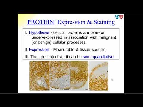 The Application of Molecular Testing to Improve Thyroid Nodule Care