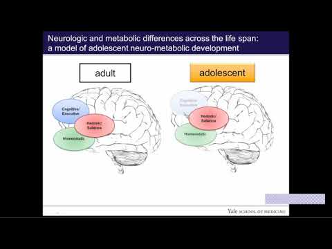 Teenage Brains on Sugar: Brain Response to Monosaccharide Ingestion in Adolescent Obesity