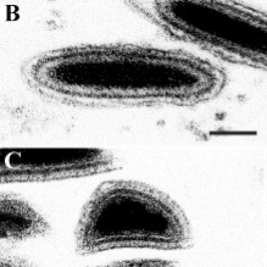 Ascoviridae