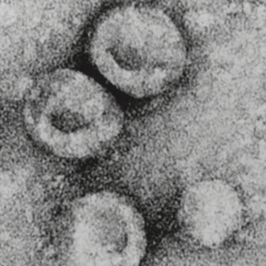 Bovine viral diarrhea virus 1