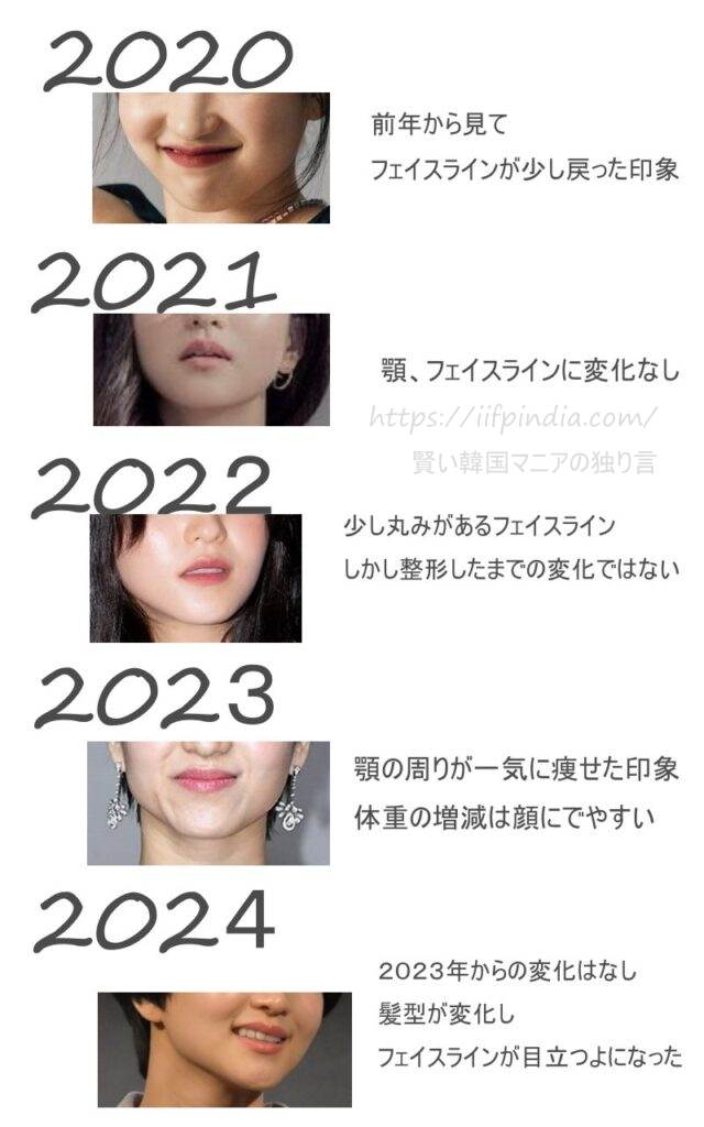 2020年から2024年までのキムテリの顎、輪郭の変化