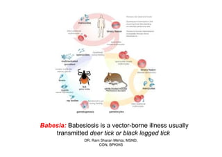 Babesia: Babesiosis is a vector-borne illness usually
    transmitted deer tick or black legged tick
               DR. Ram Sharan .Mehta, MSND,
                      CON, BPKIHS
 