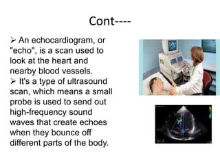 Cont----
 An echocardiogram, or
"echo", is a scan used to
look at the heart and
nearby blood vessels.
 It's a type of ultrasound
scan, which means a small
probe is used to send out
high-frequency sound
waves that create echoes
when they bounce off
different parts of the body.
 