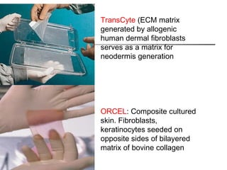 TransCyte (ECM matrix
generated by allogenic
human dermal fibroblasts
serves as a matrix for
neodermis generation
ORCEL: Composite cultured
skin. Fibroblasts,
keratinocytes seeded on
opposite sides of bilayered
matrix of bovine collagen
 